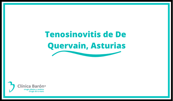 Tenosinovitis de De Quervain, Asturias