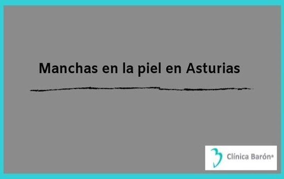Manchas en la piel en Asturias