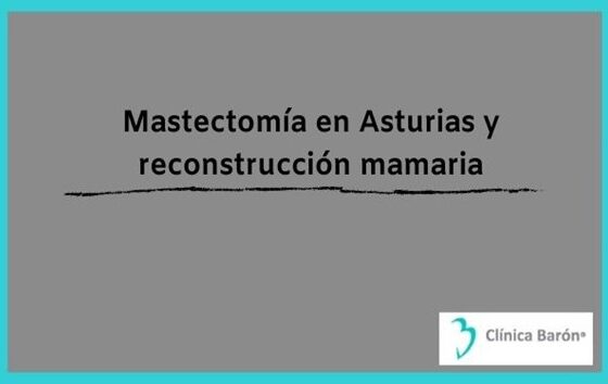Mastectomía en Asturias y reconstrucción mamaria